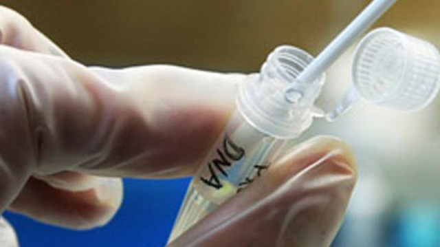 DNA Fingerprint, Teknologi Pelacakan Jejak DNA pada Keturunan dan Kriminalitas (3)