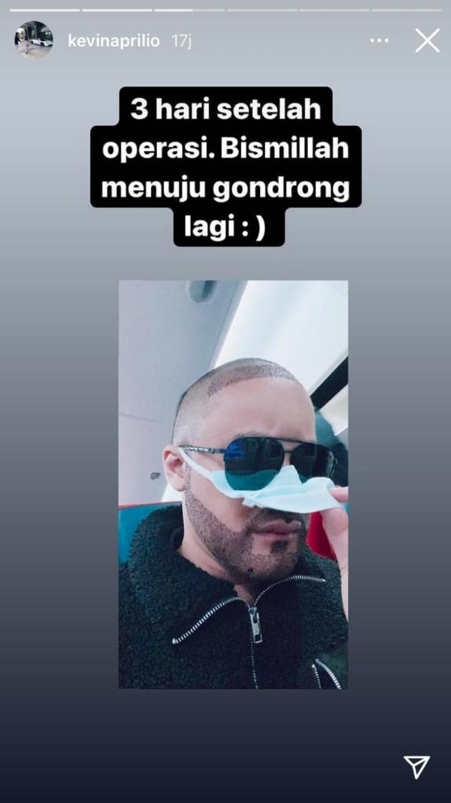 5 Berita Populer Kevin Aprilio Transplantasi Rambut Aurel Soal Atta Dihina Kumparan Com 5 Berita Populer Kevin Aprilio Transplantasi Rambut Aurel Soal Atta Dihina Kumparan Com