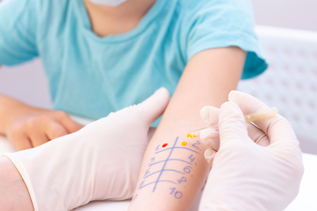 Perlu Tidaknya Anak Tes Alergi Foto: Shutterstock