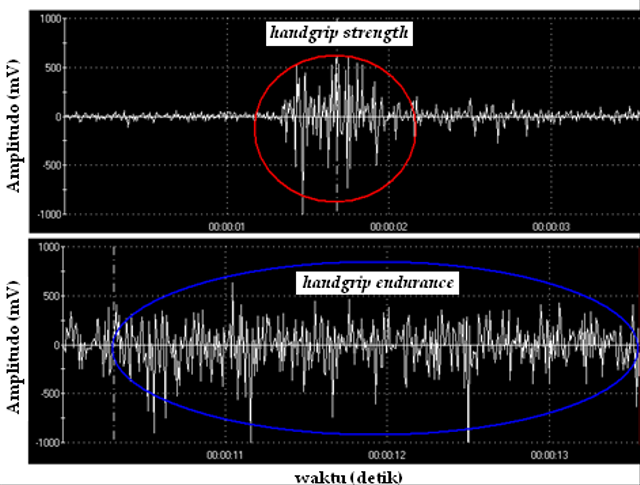 Electromyography (EMG), Ketika Otot Rangka Manusia Menghasilkan Listrik (6)