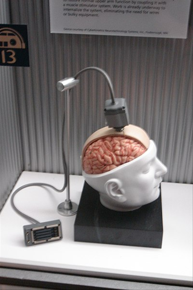 Brain-Computer Interface, Mengendalikan Kursi Roda Hanya dengan Pikiran (1)