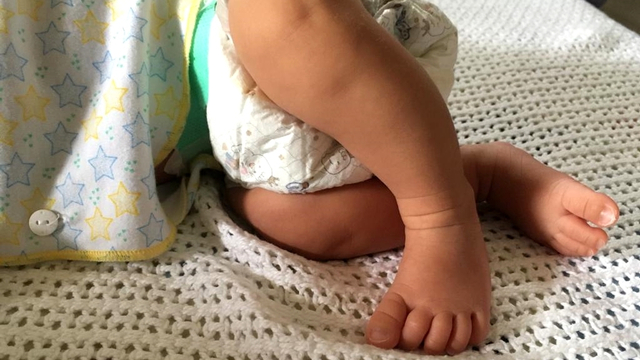 Ilustrasi kaki bayi. Foto: Fitra Andrianto/kumparan