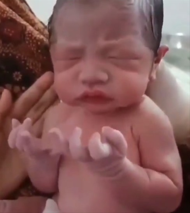 Viral bayi baru lahir tampak seperti berdoa dengan mengangkat kedua tangannya. (Foto: Instagram/@peristiwa_sekitar_kita)