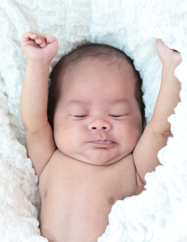 Penyebab Bayi Baru Lahir Punya Benjolan di Payuda Foto: Freepik