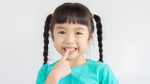 Ilustrasi gigi depan anak menguning. Foto: Shutter Stock