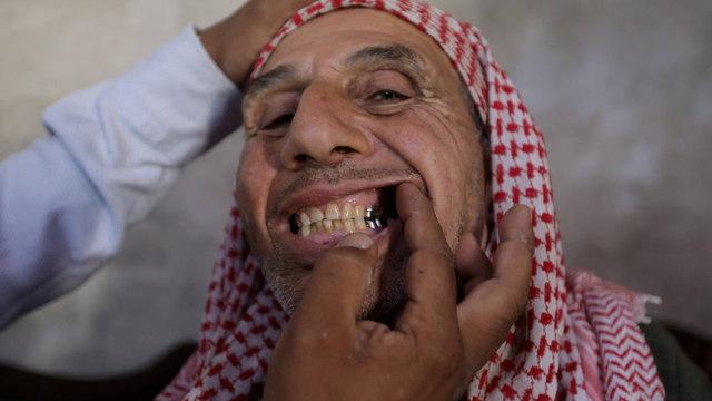 Dokter gigi bagi para pengungsi di Suriah. Foto: Amir Cohen/REUTERS