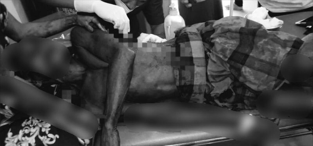 Korban Akil (60) mendapat penanganan medis usai terkena sabetan sebilah parang di tubuhnya. Foto: Dok Polres Kolaka Utara.