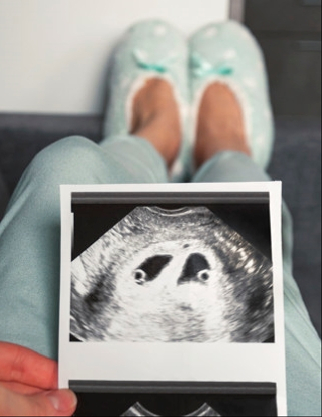 Cara Menjaga Kehamilan Anak Kembar Foto: Freepik