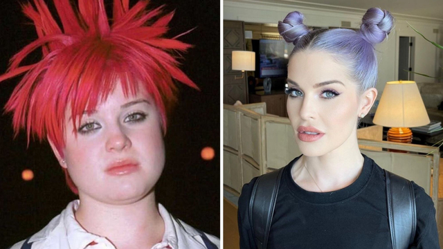 Potret before-after Kelly Osbourne/Instagram.