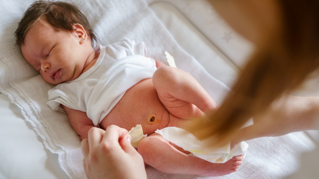 Yang Perlu Dipahami Orang Tua Soal Pipis Bayi Baru Lahir Kumparan 