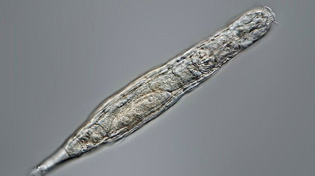 Hewan mikroskopis, Rotifera Bdelloid yang bangkit lagi setelah membeku 24.000 tahun. Foto: Michael Plewka