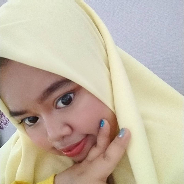 5 Potret Selebgram Kekeyi Usai Jalani Filler Hidung (27722)