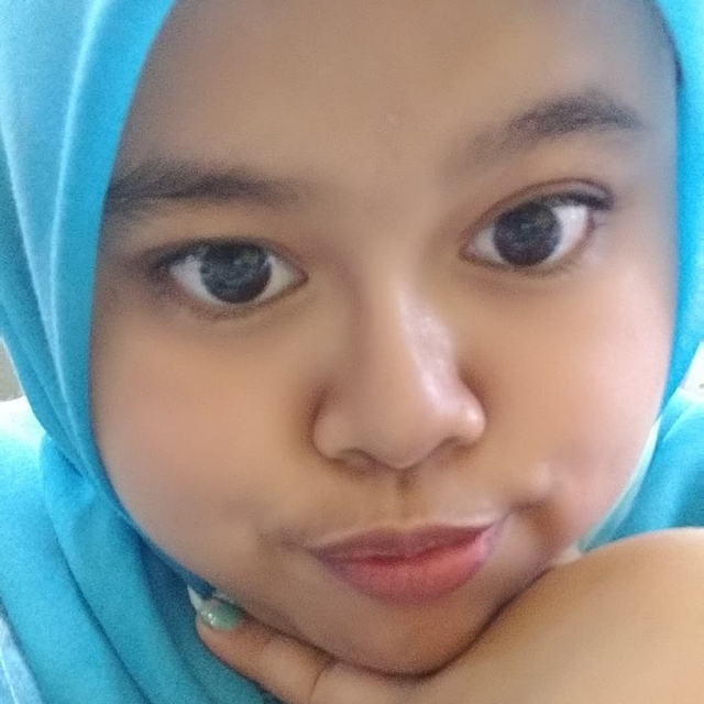 5 Potret Selebgram Kekeyi Usai Jalani Filler Hidung (27723)