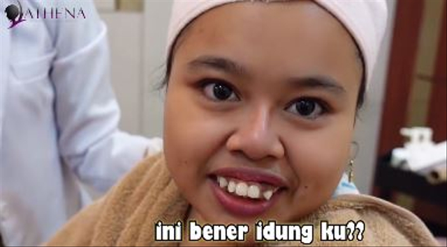 5 Potret Selebgram Kekeyi Usai Jalani Filler Hidung (27724)