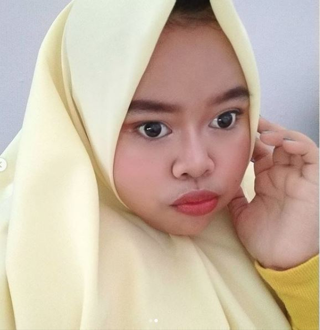 5 Potret Selebgram Kekeyi Usai Jalani Filler Hidung (27725)