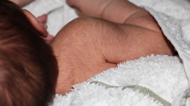 Ilustrasi bulu halus pada bayi baru lahir.
 Foto: Shutter Stock