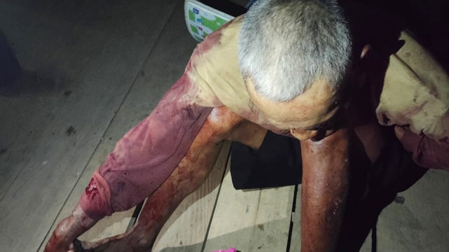 Opa, korban selamat dari tembakan KKB di Kampung Pingki, Kabupaten Yahukimo. (Dok istimewa)