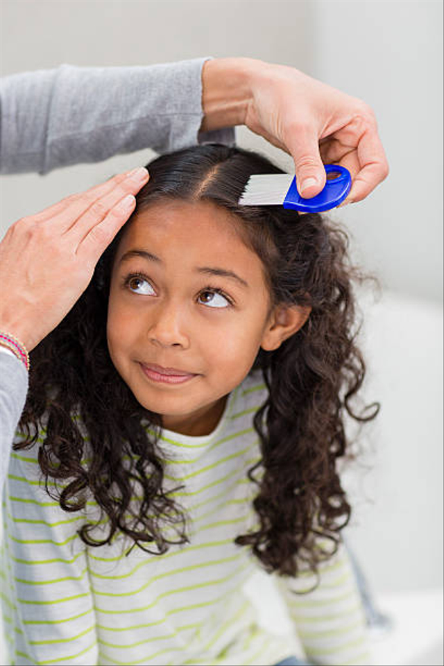 Ilustrasi mencari kutu rambut. Foto: Getty Images 