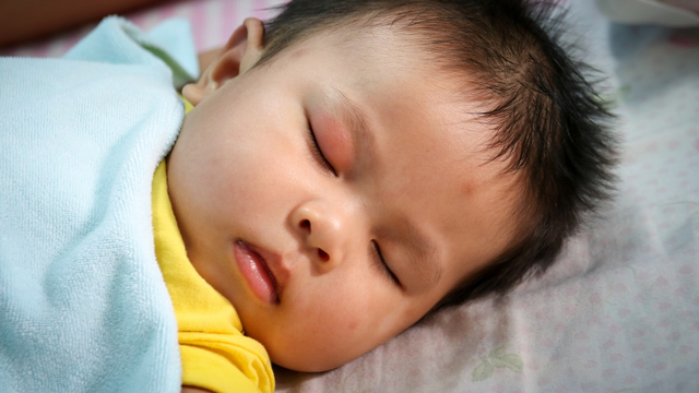 Macam-macam penyebab mata bayi bengkak Foto: Shutterstock