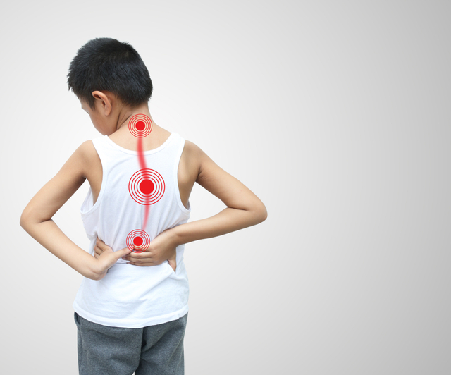 Ilustrasi sakit punggung atau skoliosis pada anak. Foto: Shutter Stock