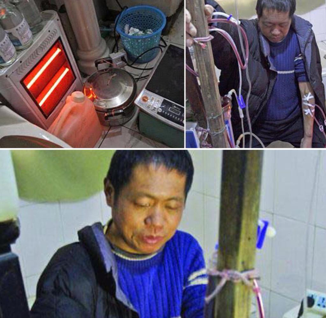 Semenjak tabungannya ludes, Hu Songwen membuat alat cuci darah sendiri dan bertahan hidup selama 13 tahun. Foto: Istimewa.