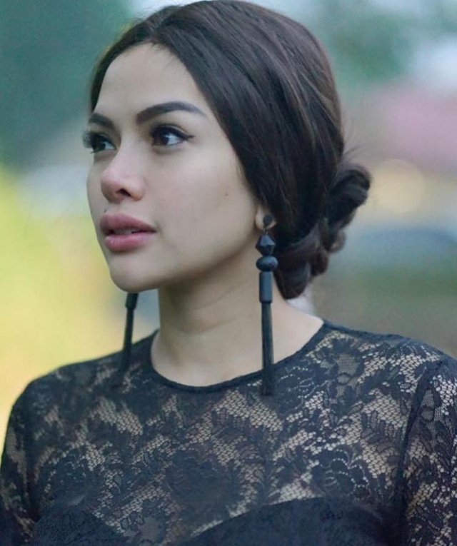 6 Artis Tanah Air yang Pernah Lakukan Oplas, Ada yang Bikin Pangling (313487)