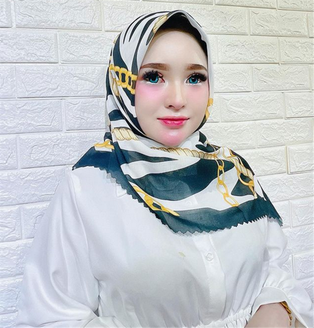7 Potret Herlin Kenza, Selebgram Asal Aceh yang Viral Akibat Timbulkan Kerumunan (357783)
