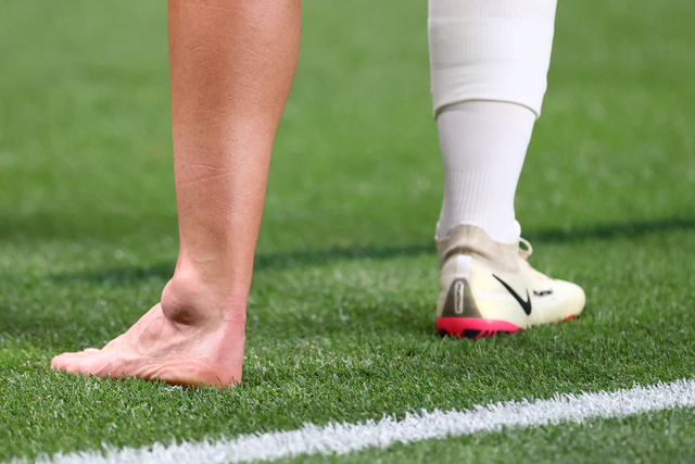 Dani Ceballos Cedera Ankle Usai Kenal Tekel Horor Pemain Mesir di Olimpiade 2020 (140401)