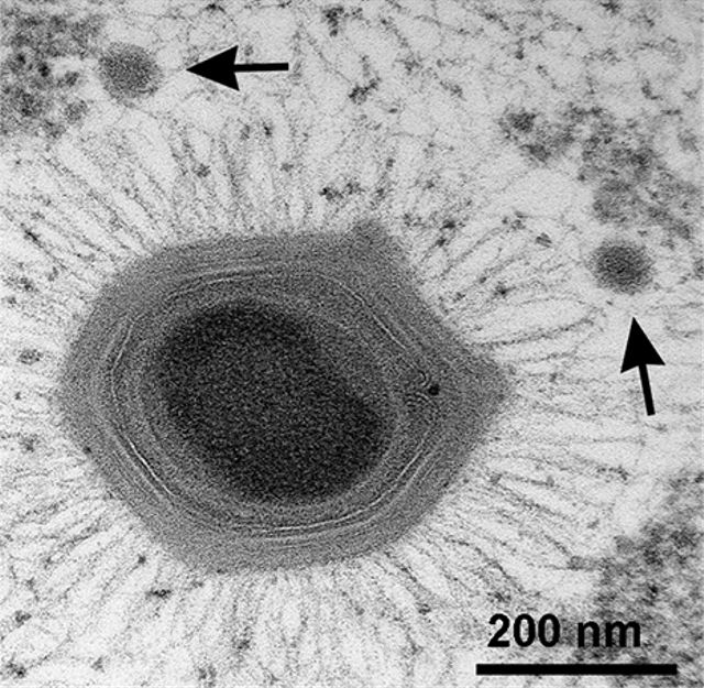 Virus Raksasa Ditemukan, Hidup di Tempat Terdalam Bumi (81383)