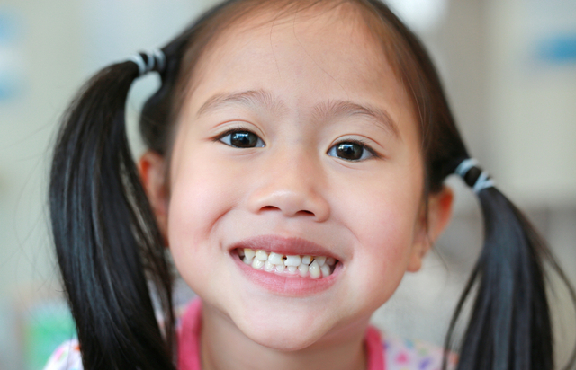 Ilustrasi kesehatan gigi anak. Foto: Shutter Stock