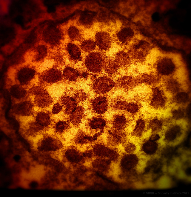 Foto asli corona varian Delta menginfeksi sel. Foto: Jason Roberts/The Doherty Institute