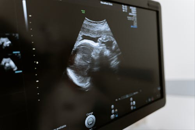 Ilustrasi Mengenal Apa Itu Zigot dalam Kehamilan. Sumber: pexels.com