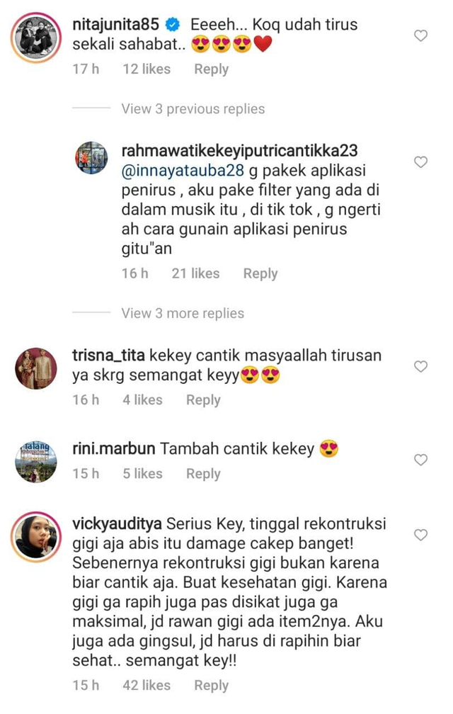 Unggah Video Terbaru Wajah Tirus Kekeyi Dipuji Netizen