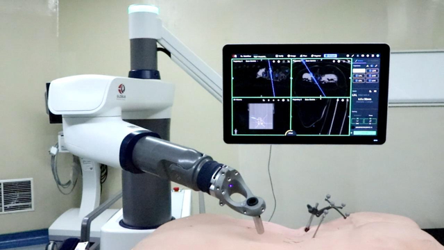 Eka Hospital memanfaatkan robot dalam operasi skoliosis. Foto: Eka Hospital