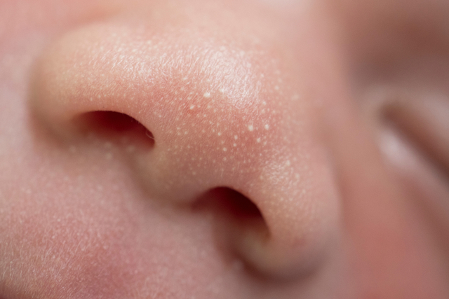 7 Fakta Tentang Kulit Bayi Baru Lahir yang Perlu Ibu Ketahui (13125)