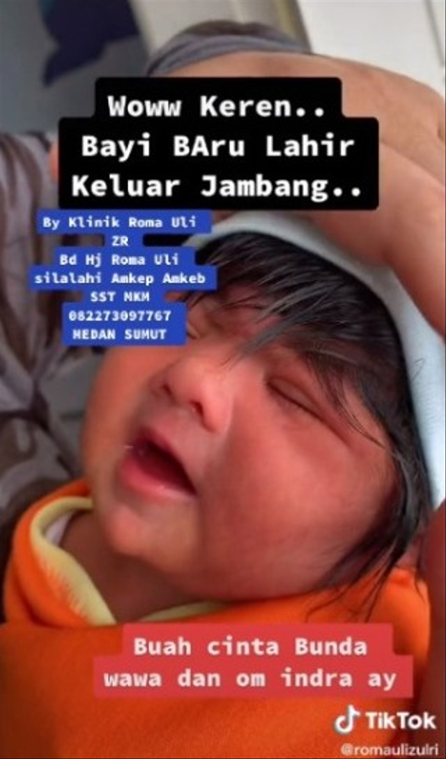 Viral seorang bayi di Medan memiliki rambut panjang dan brewok. (Foto: TikTok/@romaulizulri)