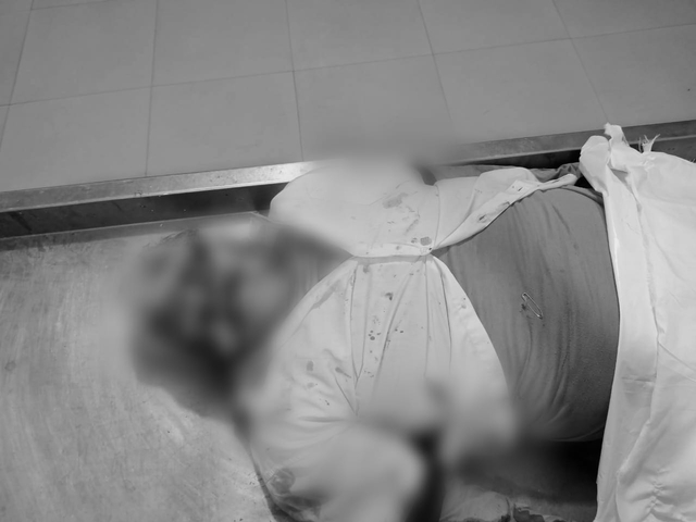 Hendak Mendahului, Mobil di Bandar Lampung Tabrak Kakek Bonceng 2 Cucu (2)