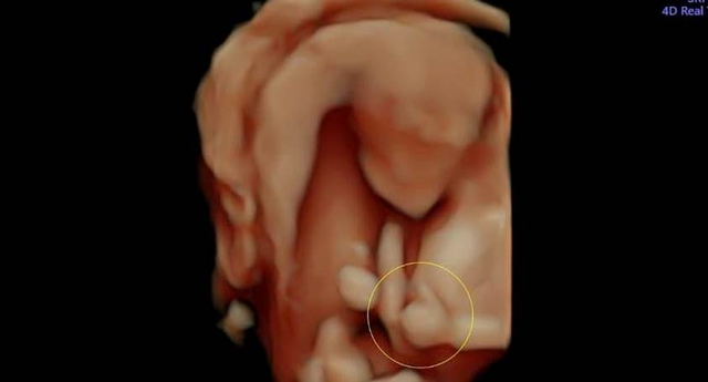 RS Unggah Foto USG Bayi di Lubuklinggau Acungkan Jempol, Sesuai Jargon Kotanya (1)