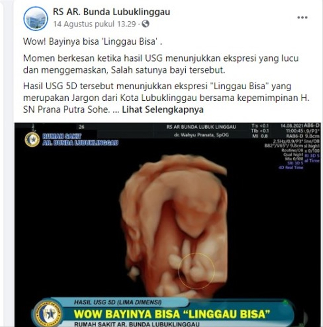 RS Unggah Foto USG Bayi di Lubuklinggau Acungkan Jempol, Sesuai Jargon Kotanya (2)