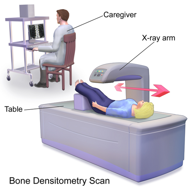 Pengukuran kepadatan tulang dengan metode DXA. Sumber: Blausen.com staff (2014). "Medical gallery of Blausen Medical 2014". WikiJournal of Medicine 1 (2). DOI:10.15347/wjm/2014.010. ISSN 2002-4436. (Wikipedia).