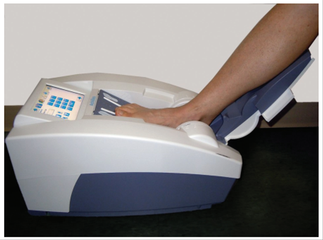 Ultrasonografi untuk Diagnosis Osteoporosis (3)