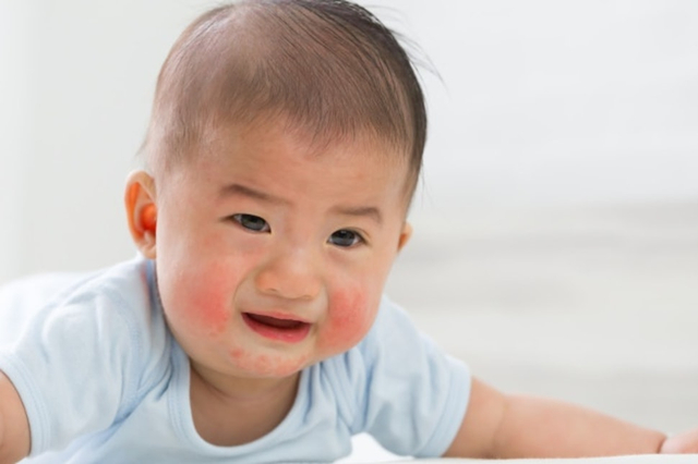 Tips Pilih Sabun untuk Mengatasi Biang Keringat Bayi. Foto: Freepik
