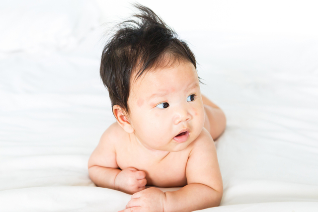 Ilustrasi bisul pada bayi. Foto: Shutter Stock