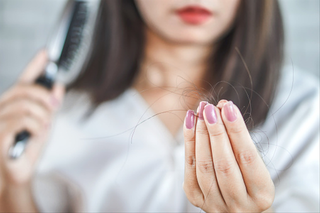 Ilustrasi rambut rontok. Sumber: pixabay