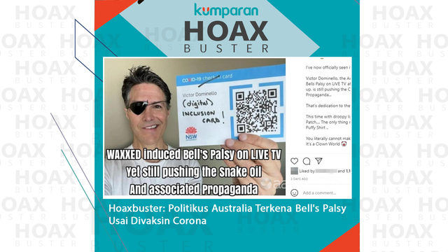 Hoaxbuster: Politikus Australia Terkena Bell's Palsy Usai Divaksin Corona  Foto: Dok. Istimewa