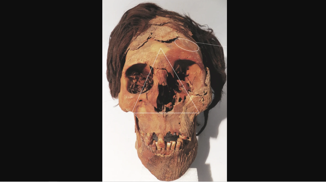 Tanda trauma mematikan di wajah. Foto: Standen/Journal of Anthropological Archaeology