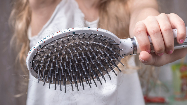 9 Masalah Rambut dan Kulit Kepala yang Bisa Terjadi pada Anak (104460)