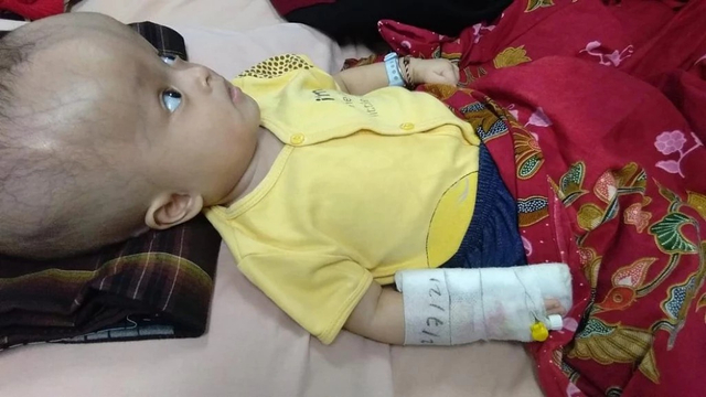 Fadhli, bayi enam bulan asal Batam, saat ini mengidap hidrosefalus. Ia sekarang tengah bertahan dengan pengobatan seadanya karena keadaan ekonomi keluarga yang kurang mendukung.
