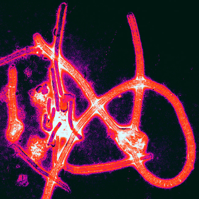 Virus ebola. Foto: Thomas W. Geisbert/Boston University School of Medicine (CC BY-SA 2.0)