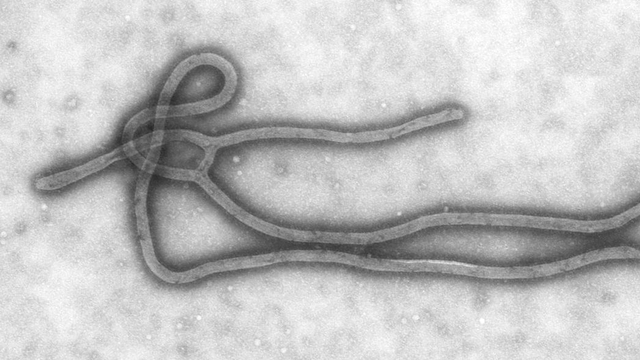 Virus Ebola Bisa Sembunyi di Tubuh Bertahun-tahun, Berisiko Picu Wabah Baru (193085)